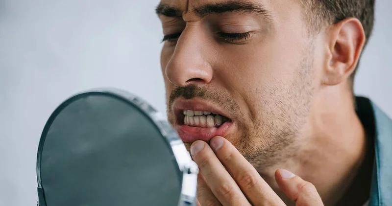 Hansı qidalar dişləri daha çox ləkələyir? Stomatoloq AÇIQLADI