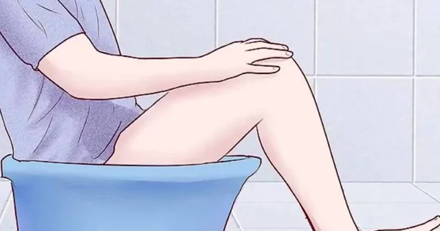 Babasil xəstəliyi (hemorroy) Foto