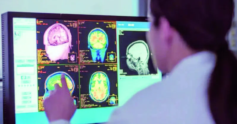 Beyinin “ömür yolu”