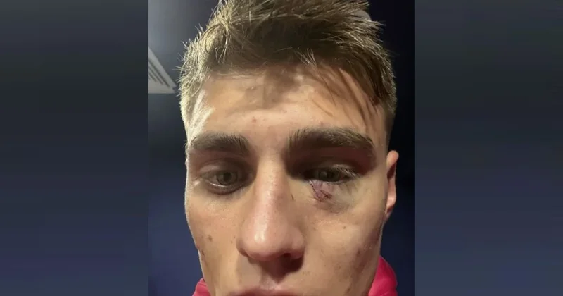 Tribunadan atılan alışqan “Qalatasaray”ın futbolçusunu bu hala saldı Foto