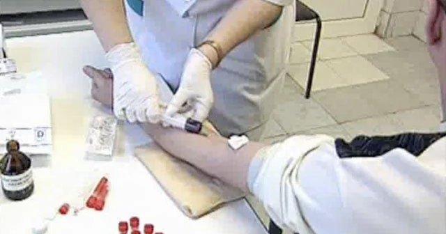 Rusiyada HİV daşıyıcılarının sayı 1,25 milyona çatıb Hər 25 kişidən biri virusla yaşayır