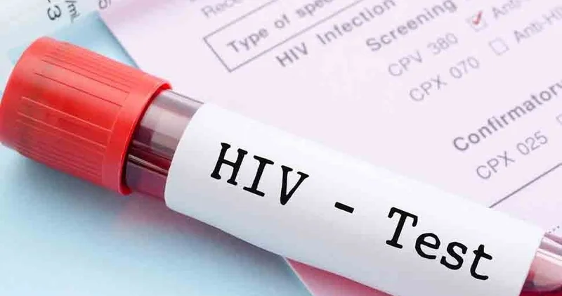 2024 cü ildə 1,3 milyon insana QİÇS diaqnozu qoyulub ÜST