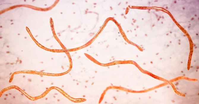 52 yaşlı supermodel bədənini qurd və parazitlərdən təmizlətdiyini ETİRAF ETDİ