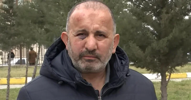 Borca görə döyülən Azəriqaz əməkdaşı: “Vur, ölsün dedilər”