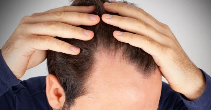 Saç tökülməsinə qarş papaq hazırlandı