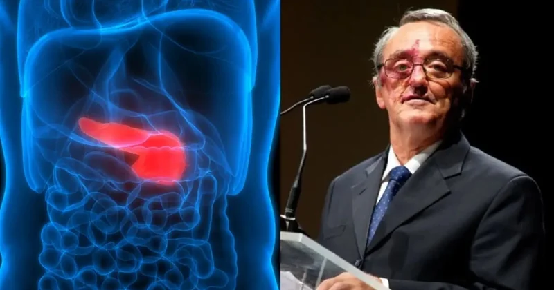 İspaniyalı alimlər mədəaltı vəzi xərçənginin müalicəsində irəliləyiş əldə etdiklərini açıqlayıblar