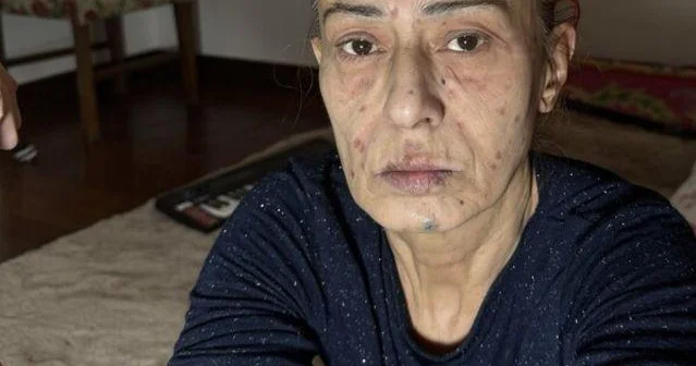 Yıldız Tilbe: İşləməsəm, ölərəm. İşləmək mənim yeganə dərmanımdır