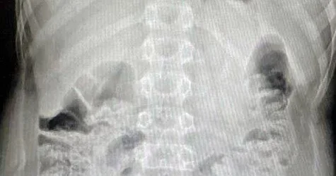 12 yaşlı uşaq pult batareyasını UDDU