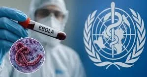 ABŞ Keniyada Ebola müalicə mərkəzi qurmağa hazırlaşır