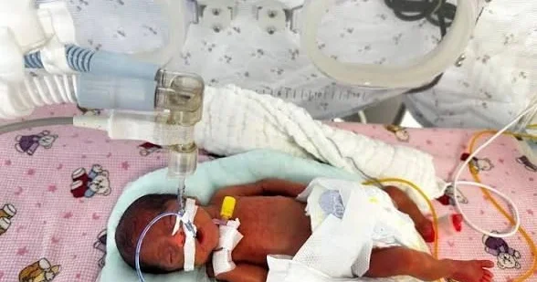 650 qramlıq körpə doğuldu FOTO