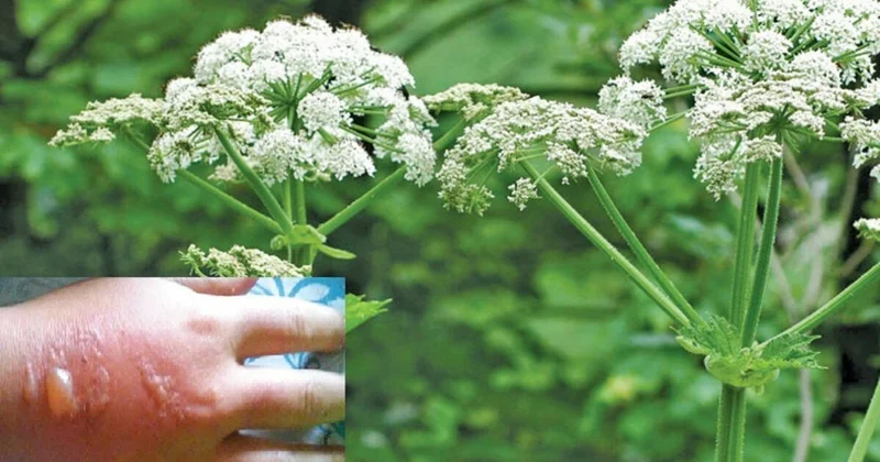 Həm dərmandır, həm də dərd: Bağ bağatınızdakı bu bitkini yalın əllə yığmayın, TƏHLÜKƏLİDİR FOTO