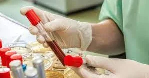 Hemoqlobinin səviyyəsini normalda necə saxlayaq?