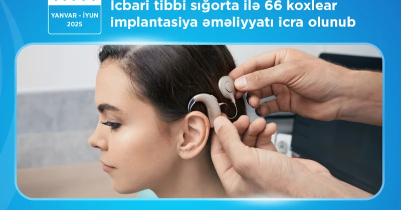 Koxlear implantasiya əməliyyatı zamanı implant və nitq prosessorunun xərclərini icbari tibbi sığorta qarşılayır