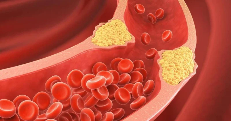 Bu meyvə xolestrini azaldır