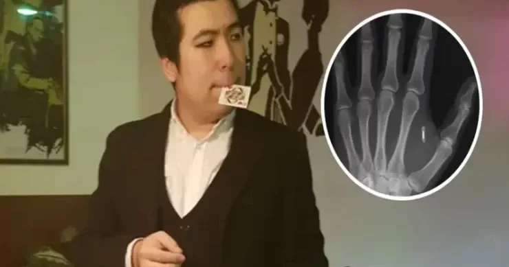 Bioloq alim əlinə yerləşdirdiyi mikroçipin şifrəsini unutdu