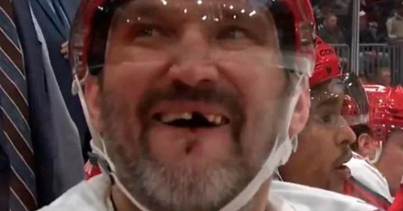 Oveçkin daha bir dişini itirdi VİDEO