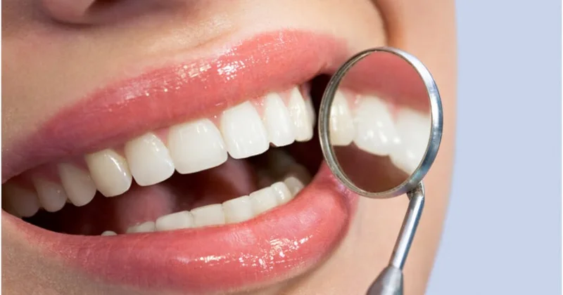 Bunları hər kəs edir Dişlərinizi dağıdan 5 zərərli vərdiş