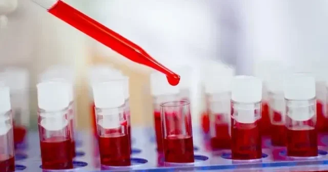 Ученые приблизились к созданию действенной вакцины от ВИЧ
