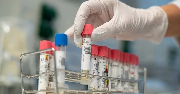 “Yeni Klinika” tibb müəssisəsində istifadə üçün nəzərdə tutulmuş laboratoriya testlərinə 10.6 milyon xərclənəcək