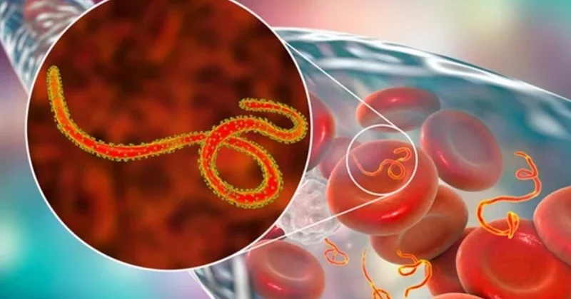 Avstraliya Afrikada Ebola ilə mübarizəyə milyonlarla dollar yardım ayıracaq