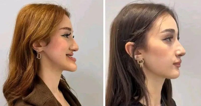 Azərbaycanlı həkimin əməliyyatı viral oldu Sosial şəbəkələrdə hamı bundan danışır VİDEO