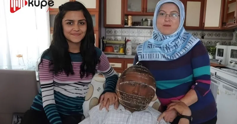 Siqareti tərgitmək üçün başına qəfəs taxdı Qeyri adi üsul FOTO