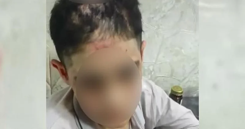 Bakıda yeniyetmə bacısı oğluna işgəncə verməkdə ittiham olunan qadın həbs olunub