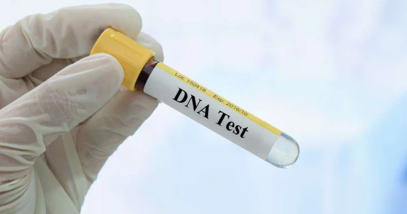 DNK testindən imtina edən atalar, bu, alimentin məbləğinə birbaşa təsir göstərir