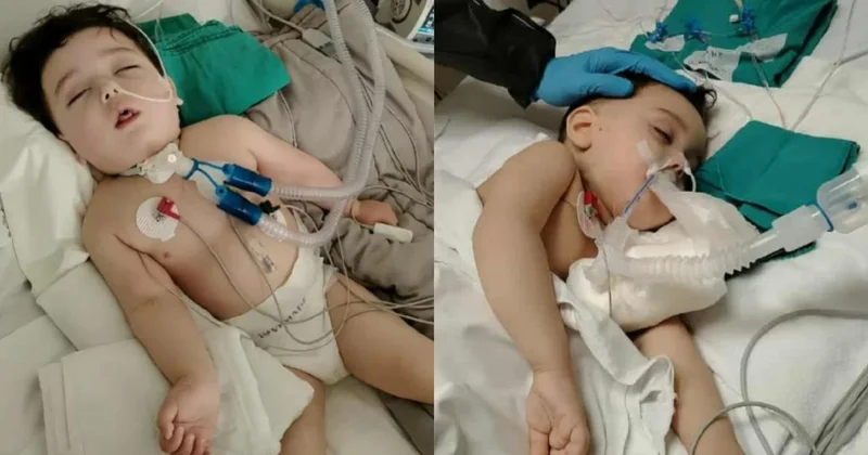 Bakıda 5 yaşlı uşağa ad günündə ətdən dəhşətli infeksiya keçdi HÜS sindromu kabusu VİDEO