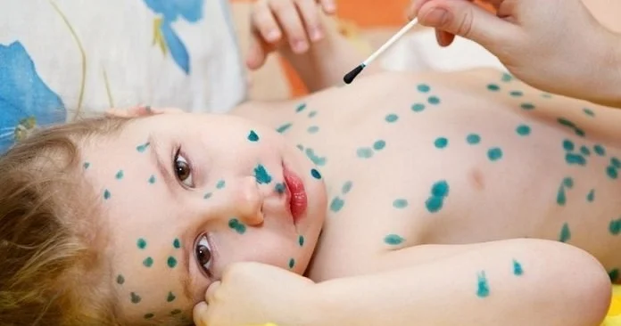 Fəsil dəyişir, bu xəstəliklər qapıda! Pediatrdan XƏBƏRDARLIQ