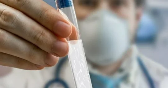 Sperm xərçəngin müalicə edə bilər ŞOK