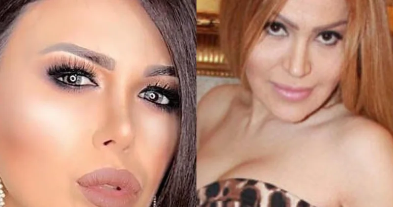 Günel Ələkbərovadan Rəqsanəyə dəstək: “Heç sığortalanmayıb”