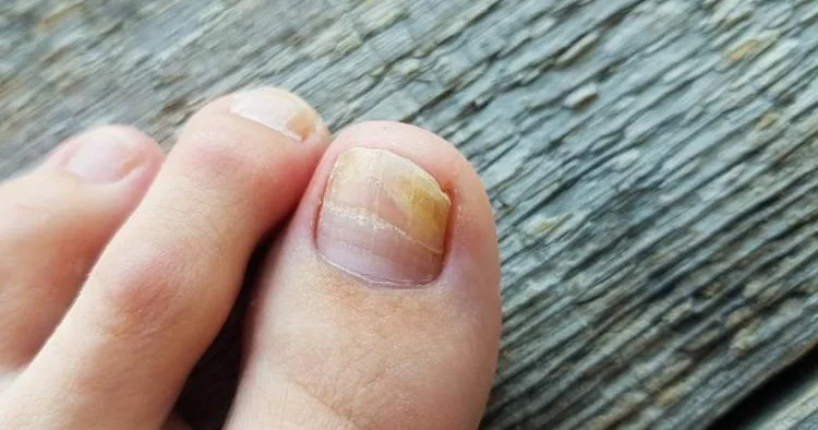 Pambıq və ya fırça ilə dırnağa çəkin KONKRET