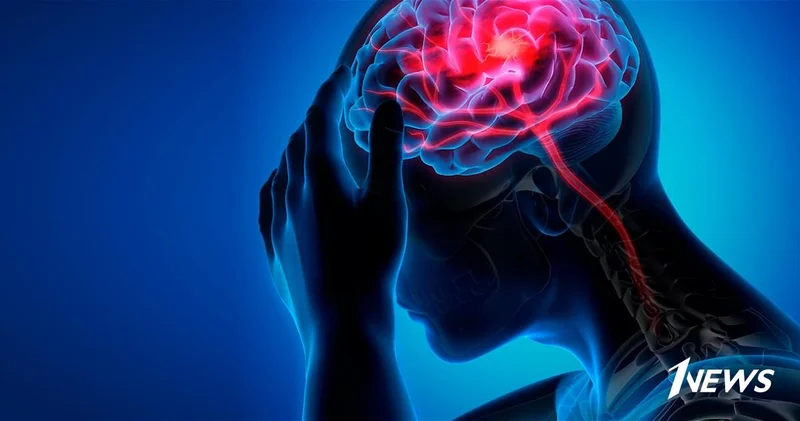 Инсульт значительно чаще поражает бедных людей, выяснили ученые