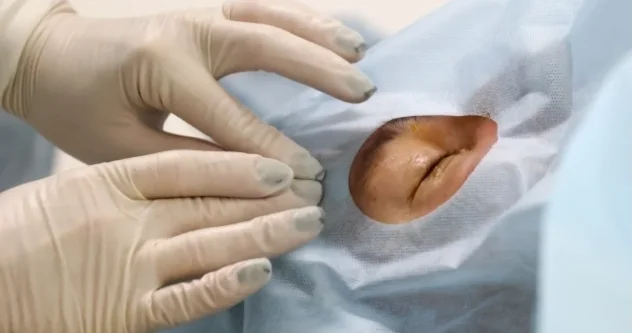 4 min kilometr məsafədən göz əməliyyatı aparıldı