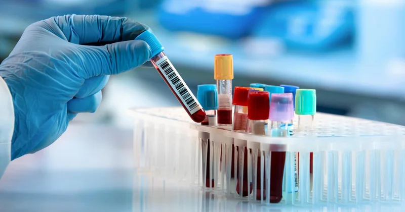 Названы биомаркеры крови, определяющие риск болезней сердца