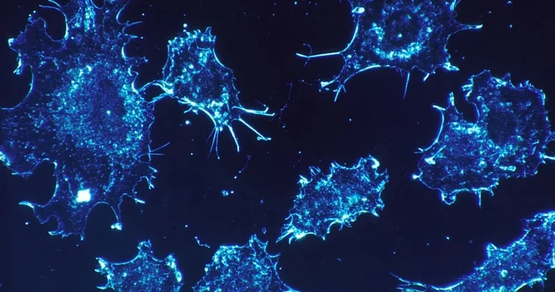 Beş növ xərçəng həyəcan siqnalı verir: qlobal artımın səbəbi nədir?