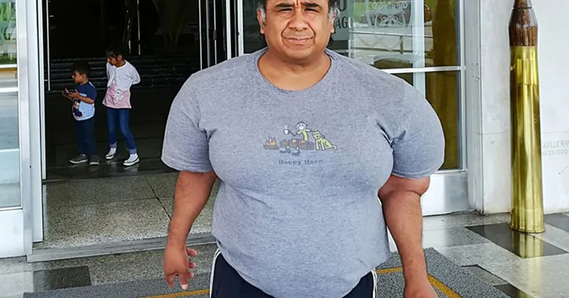 Тело мужчины распухло из за инцидента во время дайвинга