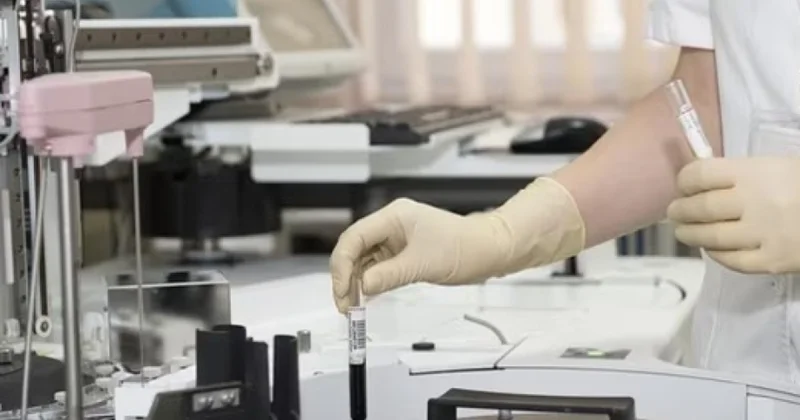 Fransada iki nəfərin MERS virusuna yoluxduğu aşkarlanıb