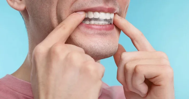 Ученые рассказали, как защитить зубы от сладкого