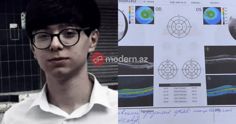 Eynəksiz görə bilməyən gənc hərbi xidmətə çağrıldı Ana şikayət edir