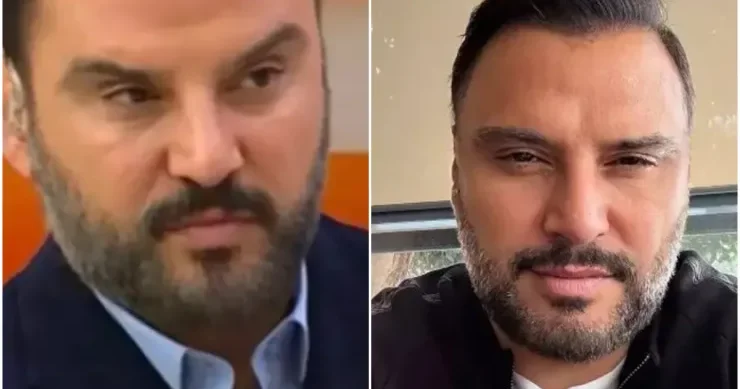 Alişan botoks etdirdiyini belə etiraf etdi FOTO