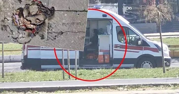 Helium şarlar bomba kimi partladı 2 uşaq yaralandı FOTO