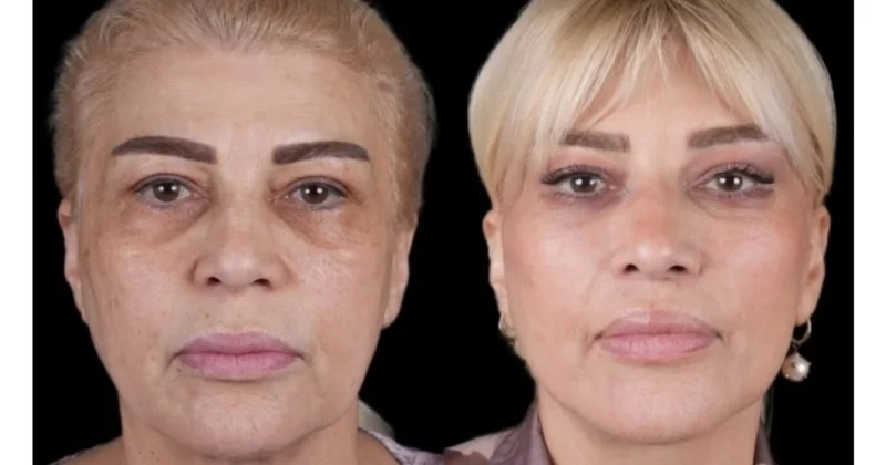Azərbaycanın üzünü gərdirib, gözünün dartdıran MƏŞHURLARI FOTOlar