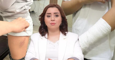 Bu məktəbdə xəsarətlə nəticələnən münaqişə valideyndən GİZLƏDİLDİ FOTO