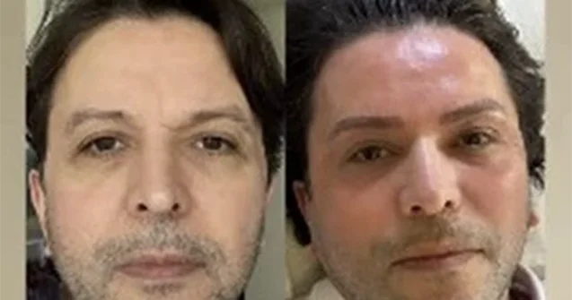 Nihat yeni görünüşü ilə gündəm oldu Foto