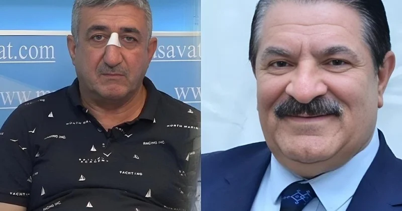 Ağadadaşın balta atdığı mühafizəçi qatarda əxlaqsız hərəkət etdiyi üçün həbs edilibmiş