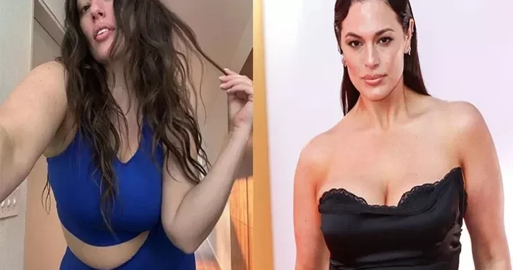 Məşhur model arıqlama iynələrindən NƏLƏR DANIŞDI “Elə bil üzümə sillə vuruldu” FOTOLENT