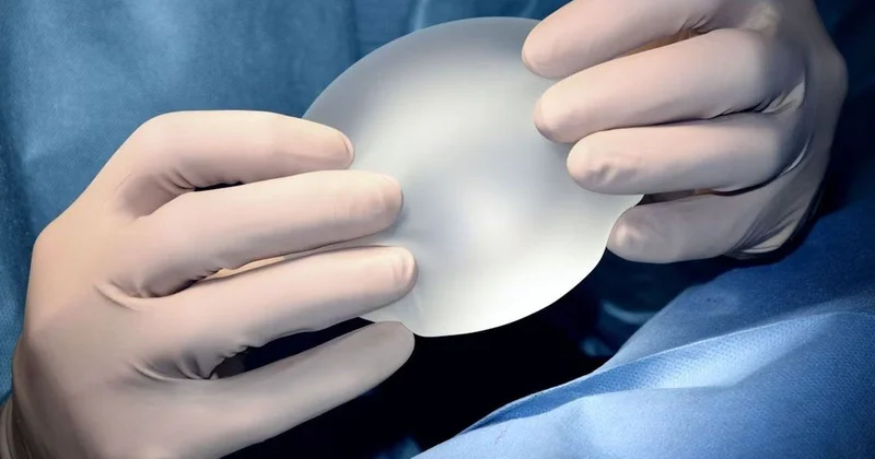 Mammoplastika əməliyyatından sonra nadir xərçəngə tutuldu