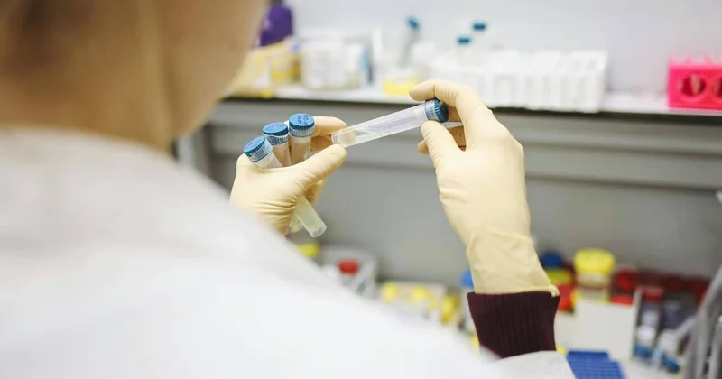 Qərbi Avropada son 70 ildə ən böyük difteriya epidemiyasının səbəbi məlum oldu